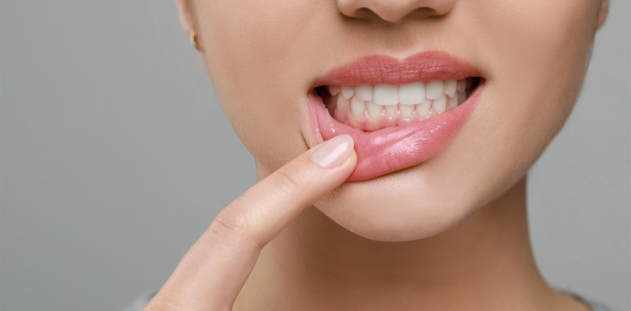 Parodontalerkrankungen verfolgen, um Behandlung zu verbessern