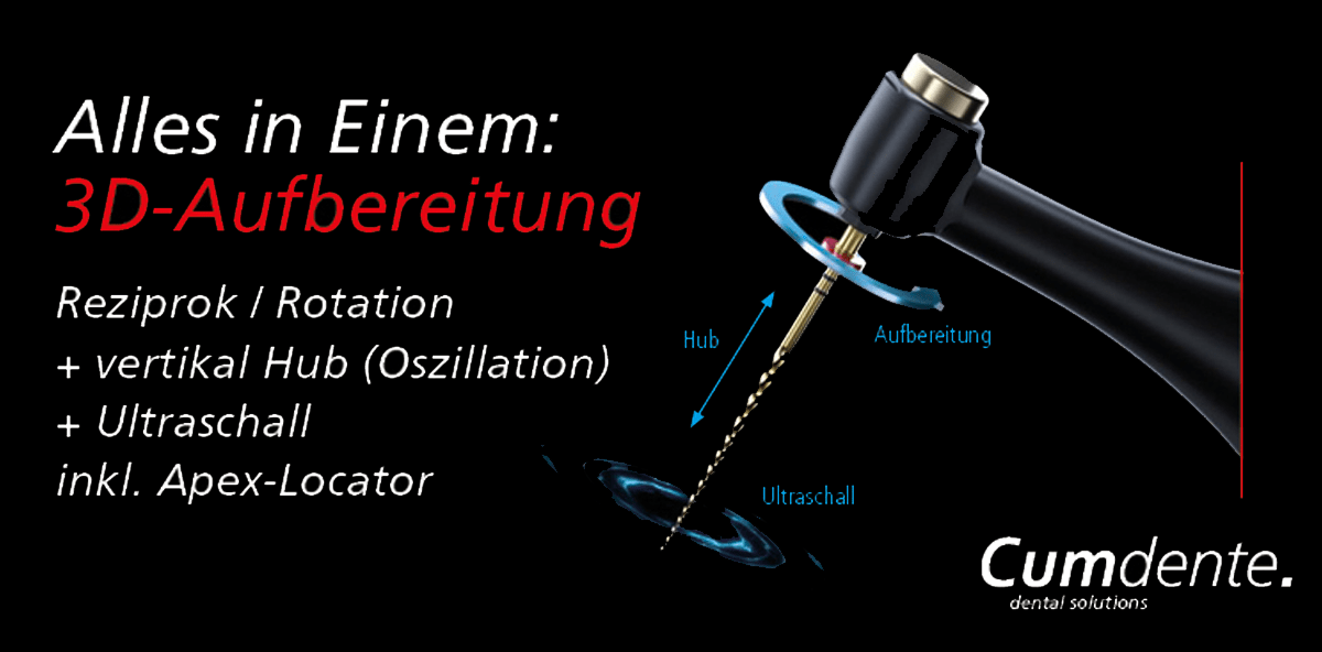 Cumdente Endo Turbo: Überwältigende erste Resonanz