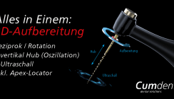 Cumdente Endo Turbo: Überwältigende erste Resonanz