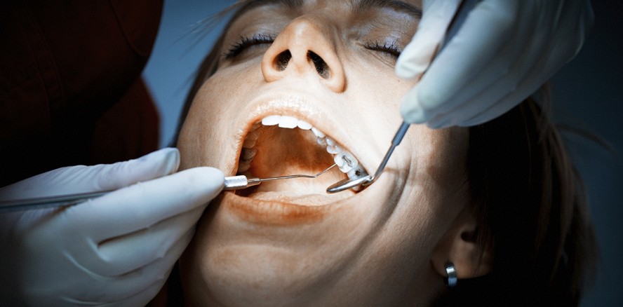 Aktuelle Bestandsaufnahme zur Amalgam-Verträglichkeit