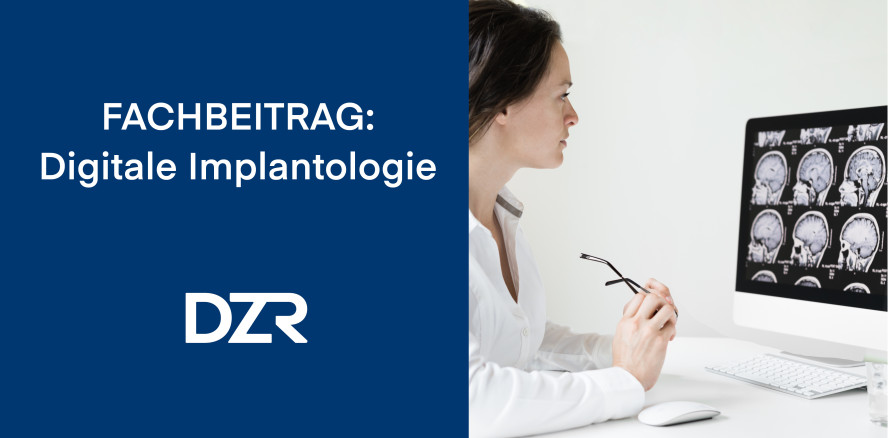 Digitale Implantologie: Smarte Workflows & GOZ-konforme Abrechnung