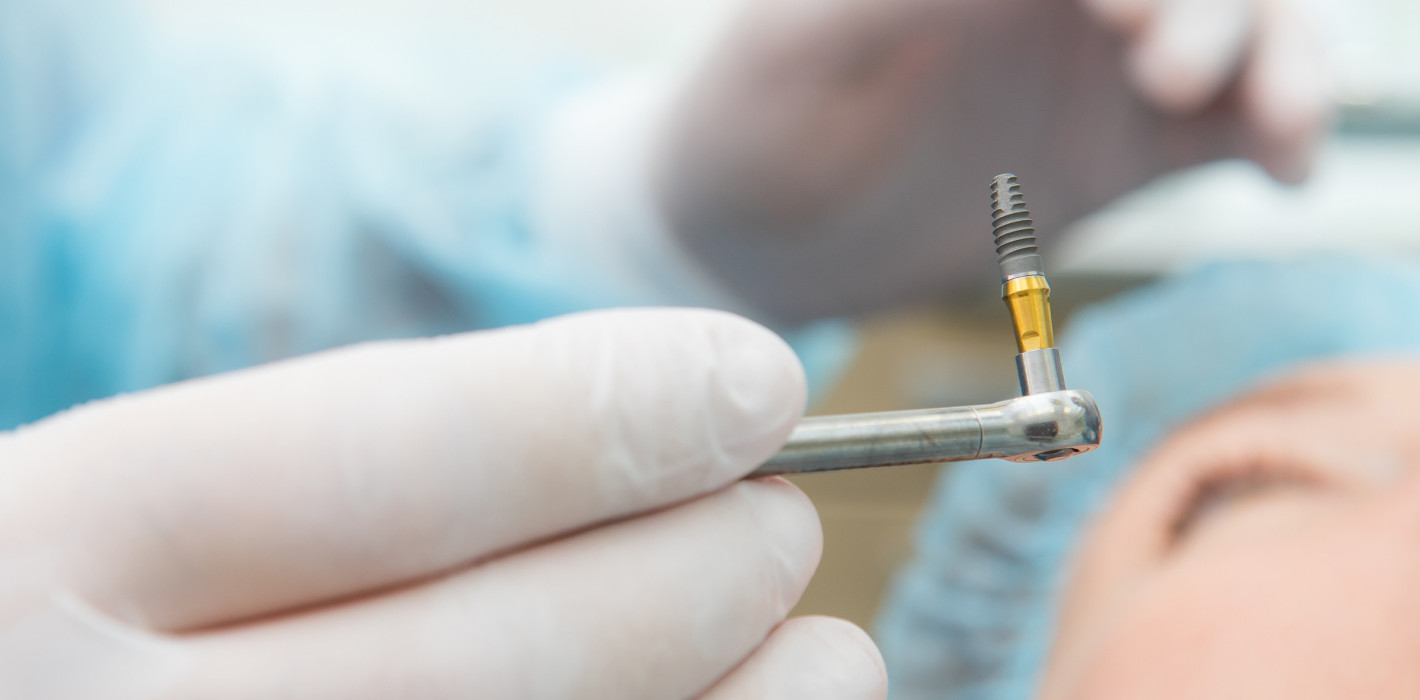 DGI plant Datenbank für Implantate