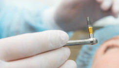 DGI plant Datenbank für Implantate
