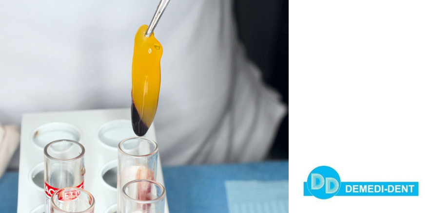 Original A-PRF nach Choukroun mit Demedi-Dent als neuem Partner