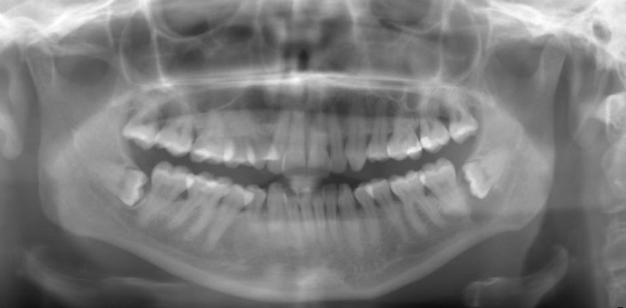 Dental-MRT: Detailliert, dreidimen­sional & ohne ionisierende Strahlung