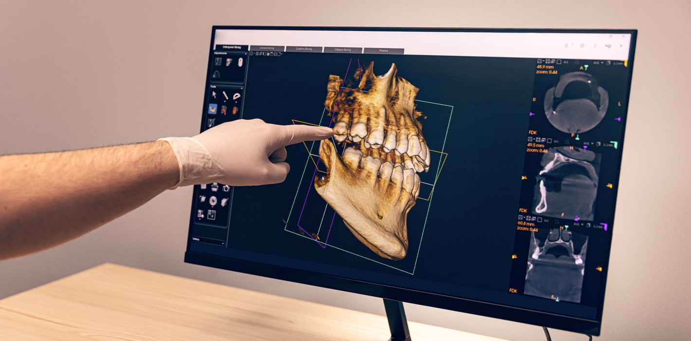 Update der S2k-Leitlinie „Dentale digitale Volumentomographie“