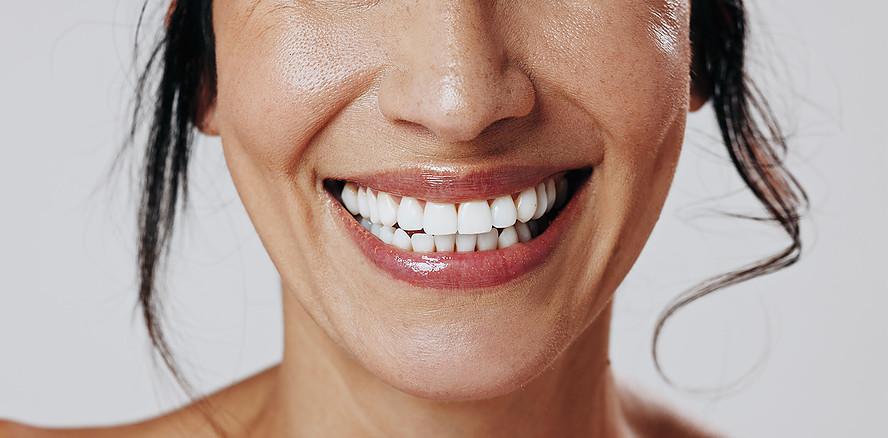 Der Weltverband der Zahnärzte FDI startet "Generation Smile"