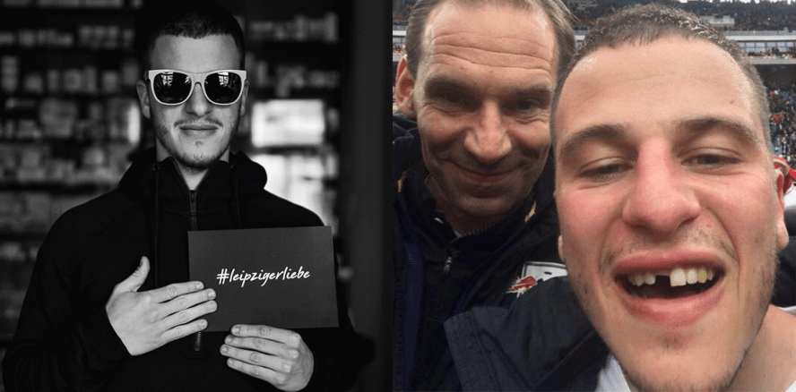 Ball drin, Zahn weg: RB-Spieler bezahlt Traumtor mit Frontzahn