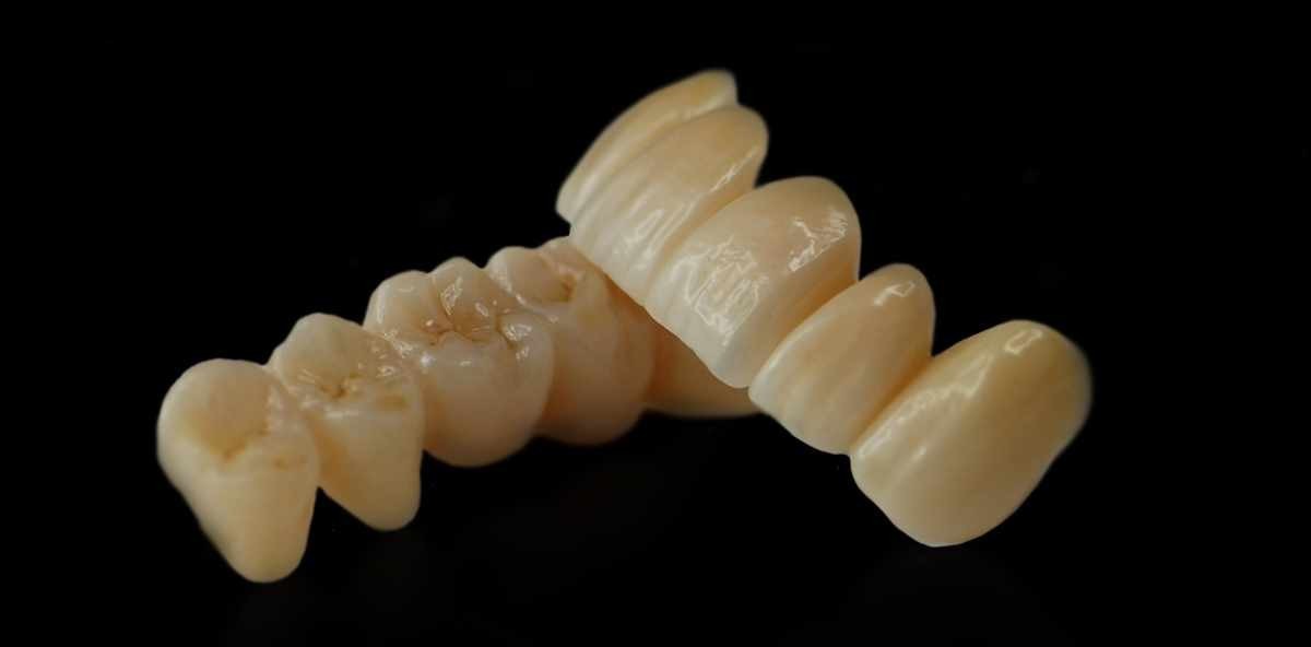 Nacera Pearl Natural – wirtschaftlich und sicher