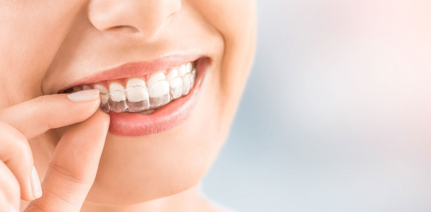 Vom Aligner-Startup zur Zahnarztpraxis-Kette