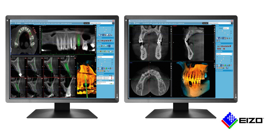 EIZO Monitore: Für eine exakte zahnärztliche Befundung