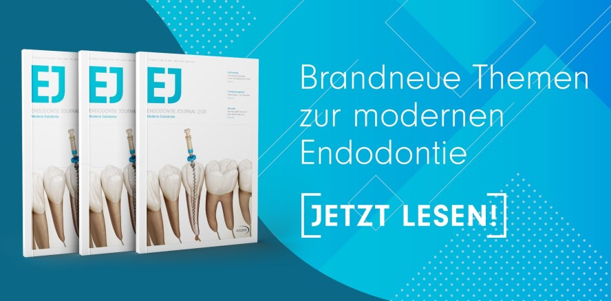 Das aktuelle Endodontie Journal jetzt schon als ePaper lesen