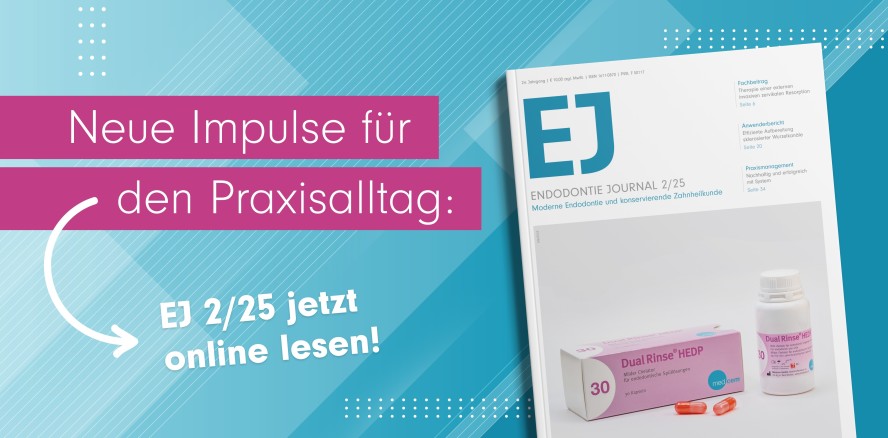 Praxisrelevante Erkenntnisse im Fokus: Das neue EJ Endodontie Journal