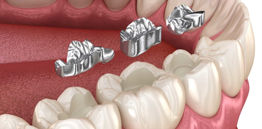 EU-Kommission will Verwendung von Quecksilber einschränken