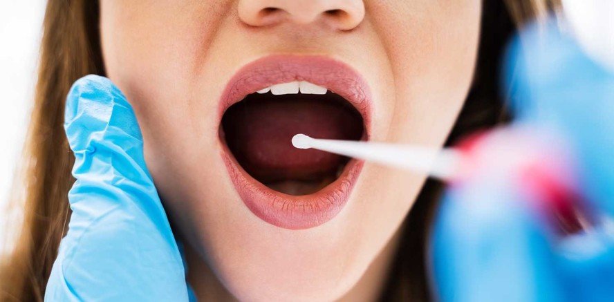 Endometriose-Diagnose über neuen Speicheltest