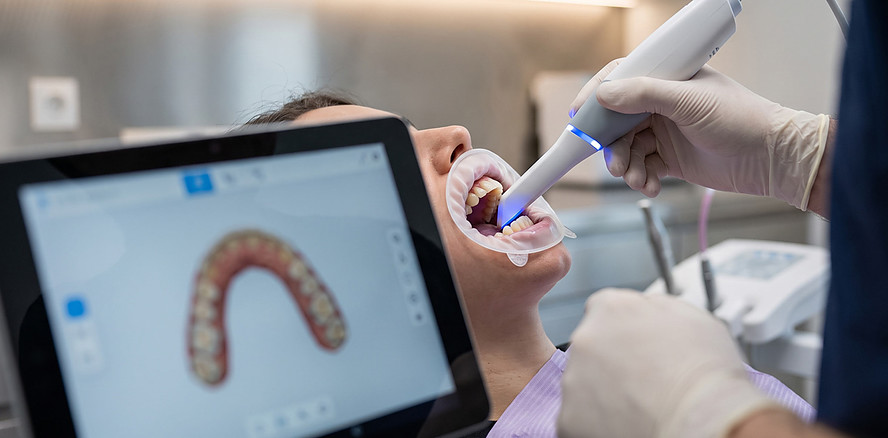 Erstmals Leitlinie zum Intraoralscan in der Zahnmedizin erschienen