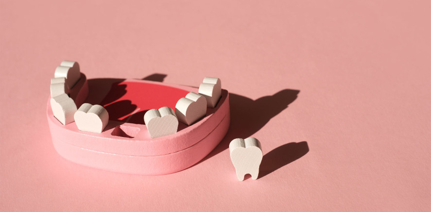 Fehlende Zähne, steigendes Risiko – NHANES-Daten verknüpfen Zahnverlust und Schlaganfall