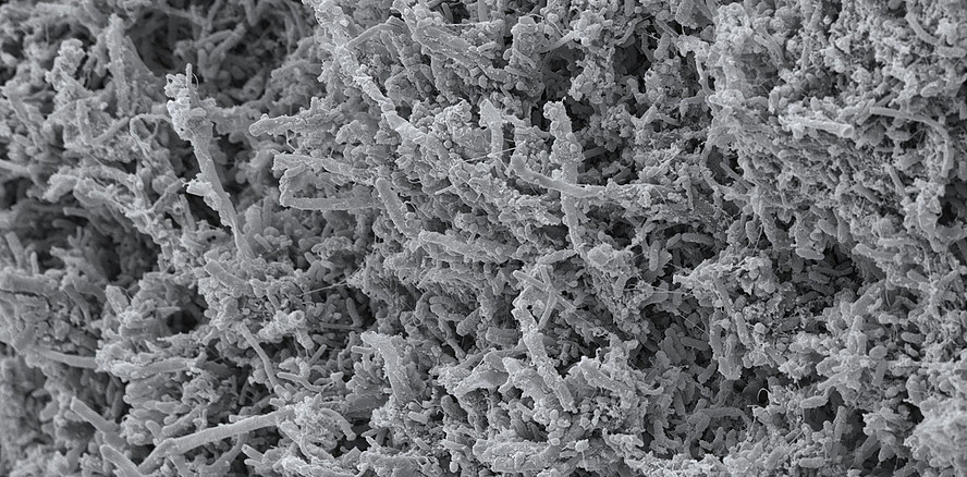 Wie Biofilme im Mund entstehen: 650.000 Euro für Mikrobiom-Forschung