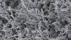 Wie Biofilme im Mund entstehen: 650.000 Euro für Mikrobiom-Forschung