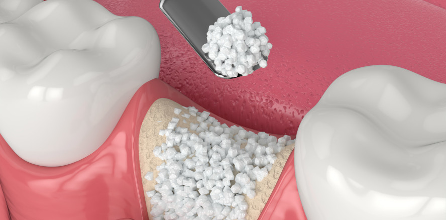 UniBE Foundation errichtet Stiftungsprofessur für Gewebehistologie