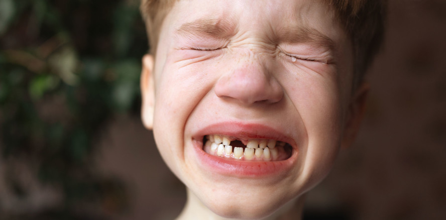 Frontzahntrauma betrifft 6 bis 38 % der Kinder und Jugendlichen
