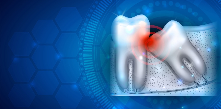 Forscher lüften das Geheimnis um die Weisheitszähne