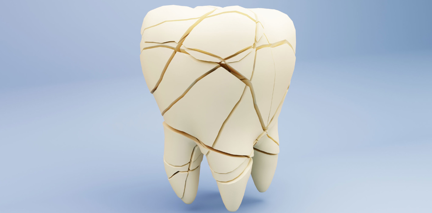 Kann man Zahnschmelz wirklich wieder aufbauen? Neues Protein-Gel verspricht Regeneration