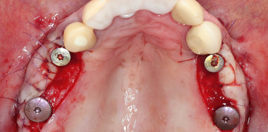 Umsetzung eines Gesamtkonzeptes einer interdisziplinären Rehabilitation