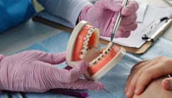 Geplante GKV-Regelungen bedrohen zahnärztliche Versorgung