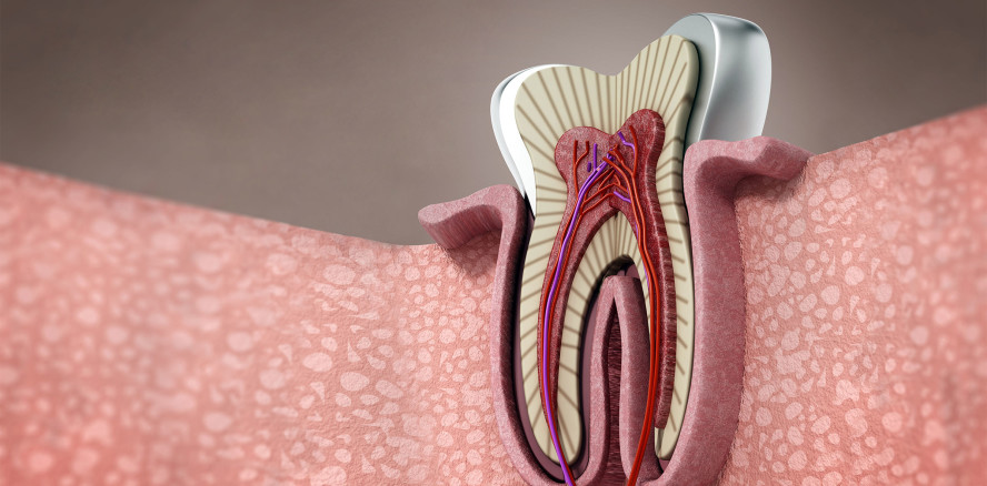 Endodontie – Geweberegeneration mit RvE1