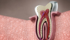 Endodontie – Geweberegeneration mit RvE1