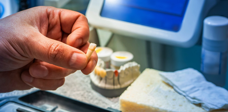 Gewinnanteil von zahntechnischen Leistungen im eigenen Labor