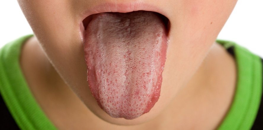 Neue Behandlung bei Mundgeruch: Annatto und blaues Licht