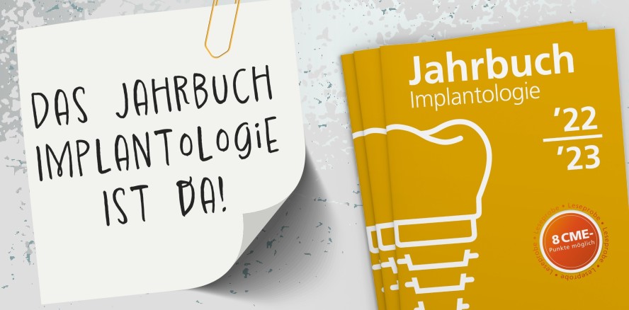 Aktuelles Kompendium zur Implantologie 2022/23