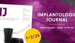 State of the Art in der Implan­tologie: Das neue IJ ist da
