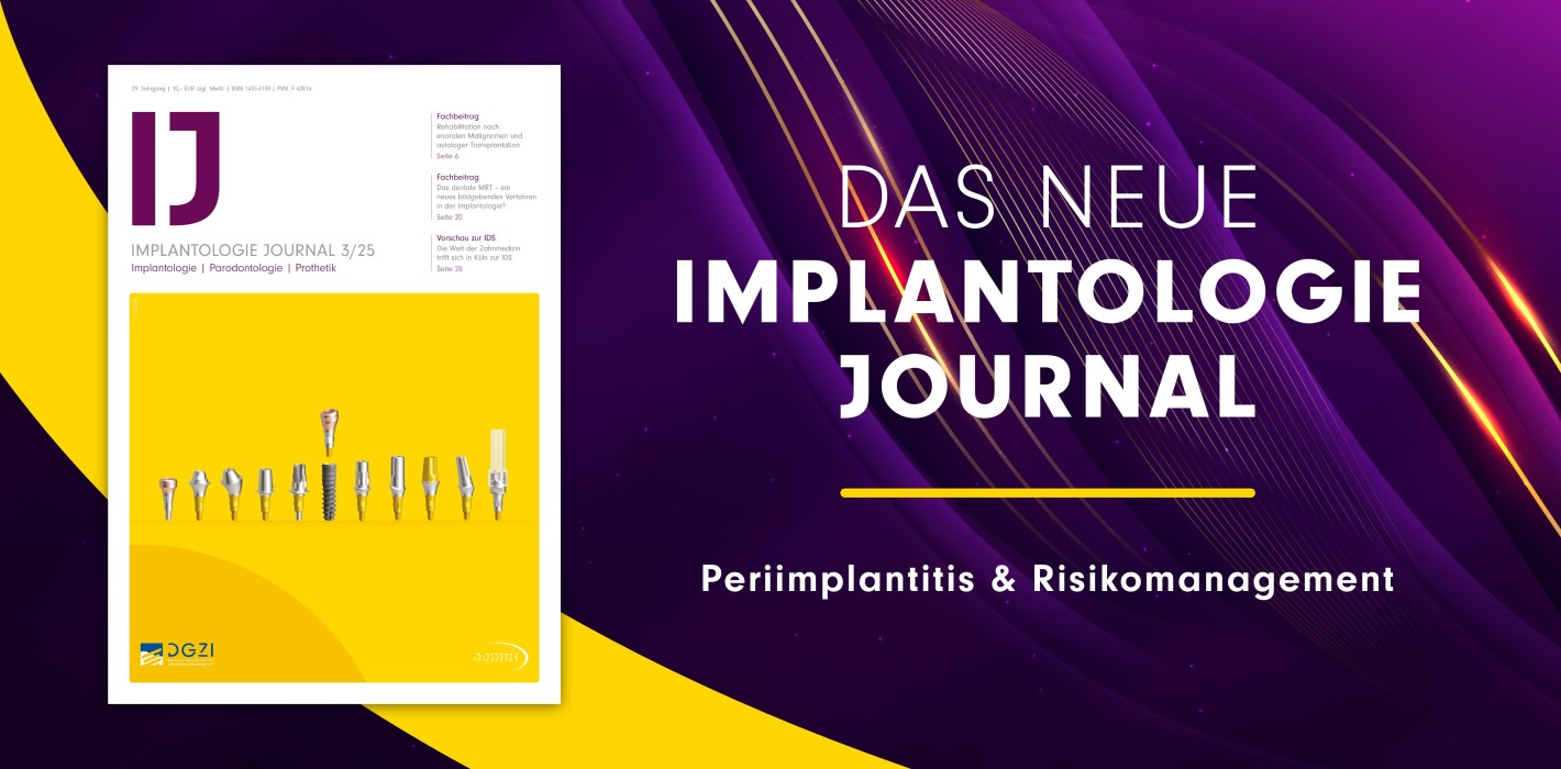 IJ 03/25: Einblicke in Periimplantitis und Risikomanagement