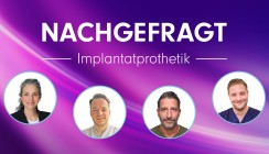 Nachgefragt: Implantatprothetik