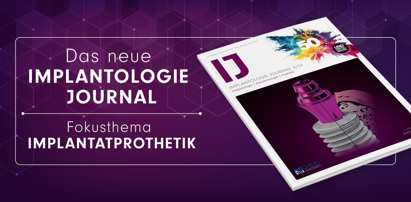 Schwerpunktthema Prothetik im brandneuen Implantologie Journal