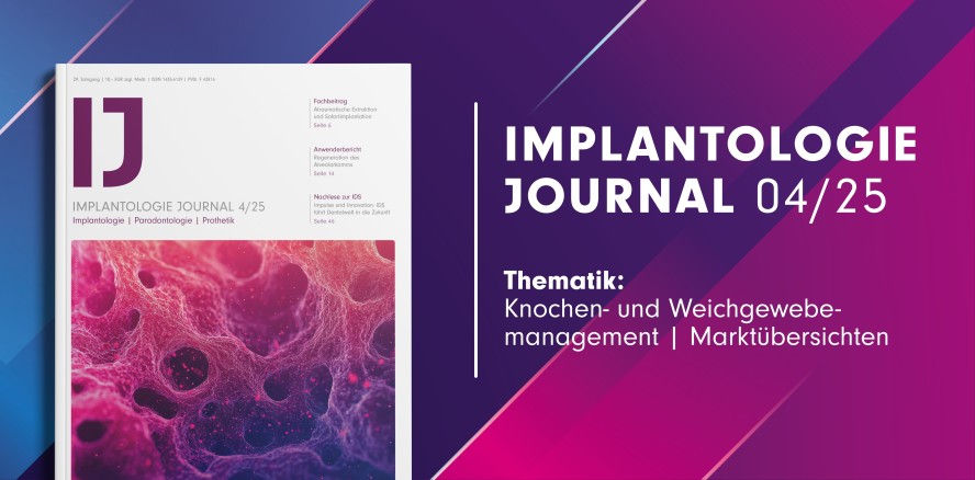 IJ 04/25: Fokus auf Knochen- und Weichgewebemanagement