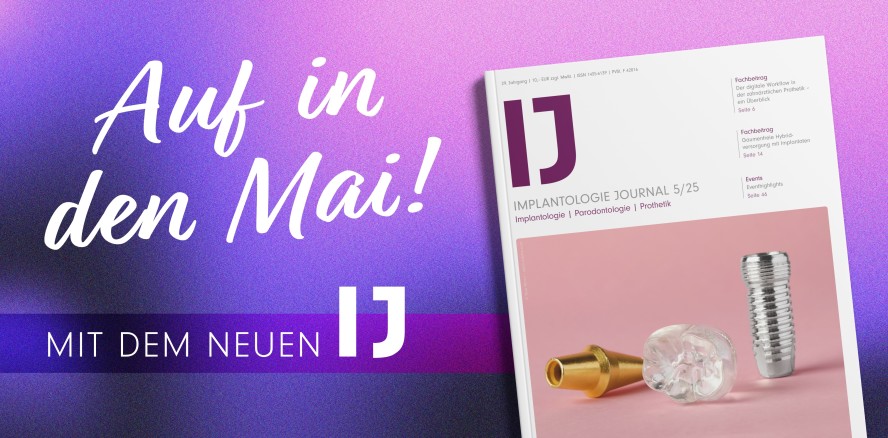 Hybride Lösungen der Implantatprothetik im IJ 5/25