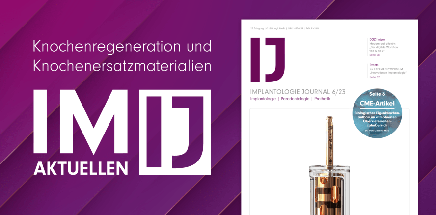 Knochenersatzmaterialien im Fokus des aktuellen IJ