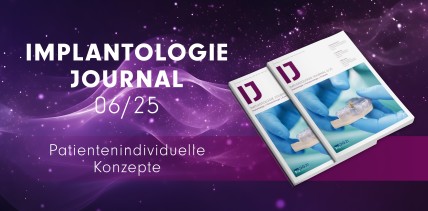 Individuelle Implantatversorgung – Das druckfrische IJ 6/25 jetzt online lesen