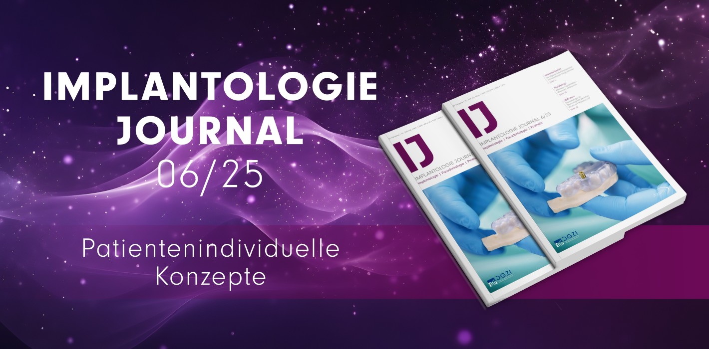 Individuelle Implantatversorgung – Das druckfrische IJ 6/25 jetzt online lesen
