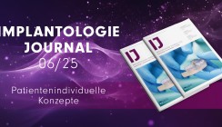 Individuelle Implantatversorgung – Das druckfrische IJ 6/25 jetzt online lesen