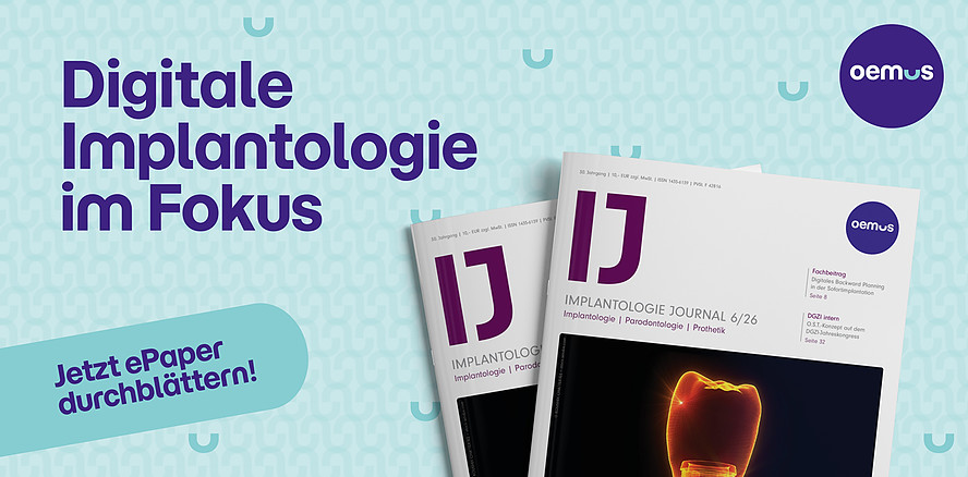 Ausgabe 6/26 des IJ Implantologie Journal stellt den digitalen Workflow in der Implantologie in den Fokus