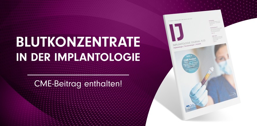 Aktuelles IJ: Blutkonzentrate in der modernen Implantologie