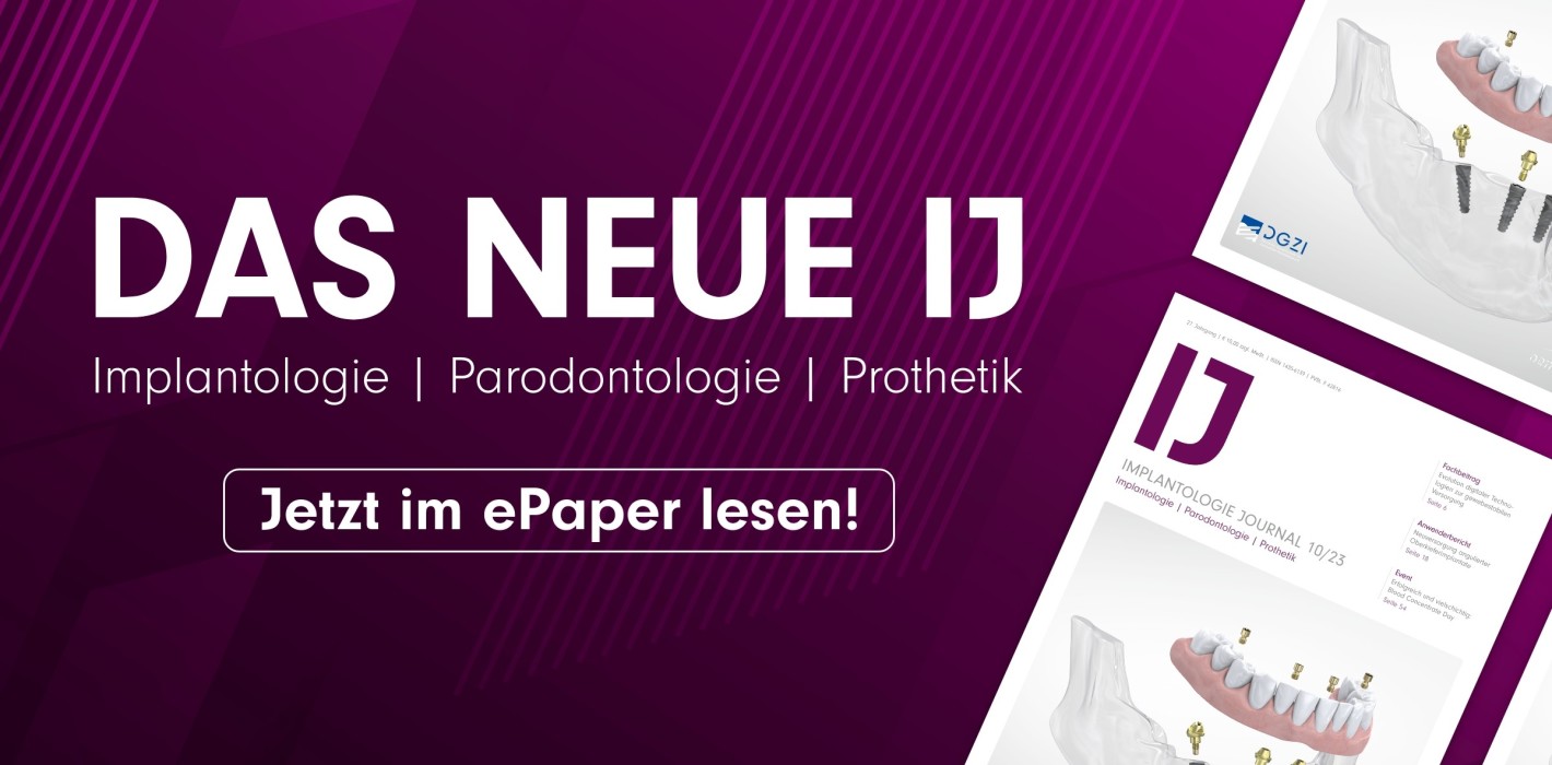 Aktuelles Implantologie Journal zum Thema „Digitalisierung“