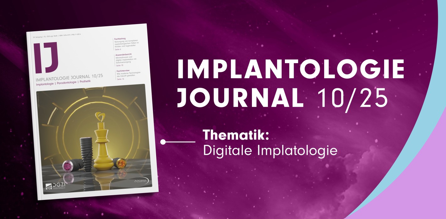 Implantologie Journal 10/25 – Neue Perspektiven durch digitale Technologien