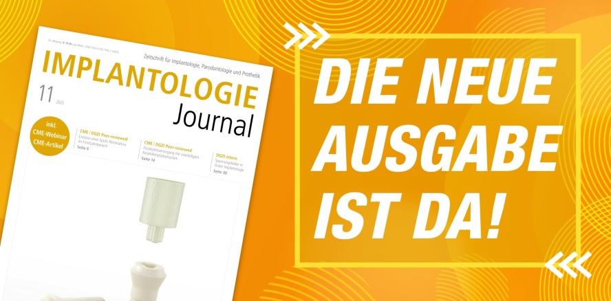 Aktuelles Implantologie Journal: Minimalinvasive Implantologie
