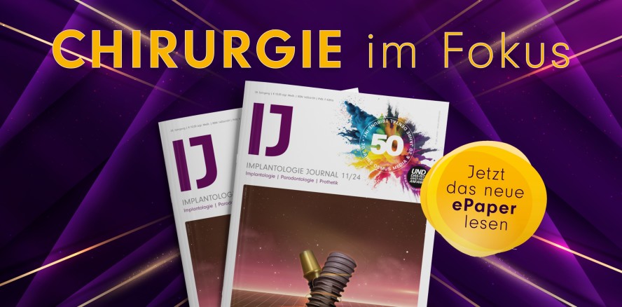 Implantologische Chirurgie im Fokus: Das neue IJ als ePaper lesen